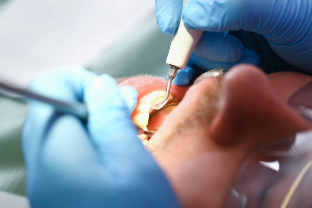 Best Emergency Dental Services for Seniors in Richmond, TX